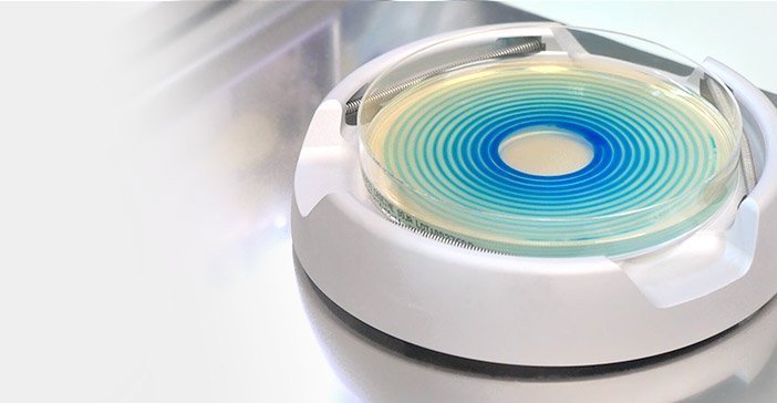 スパイラル塗抹法